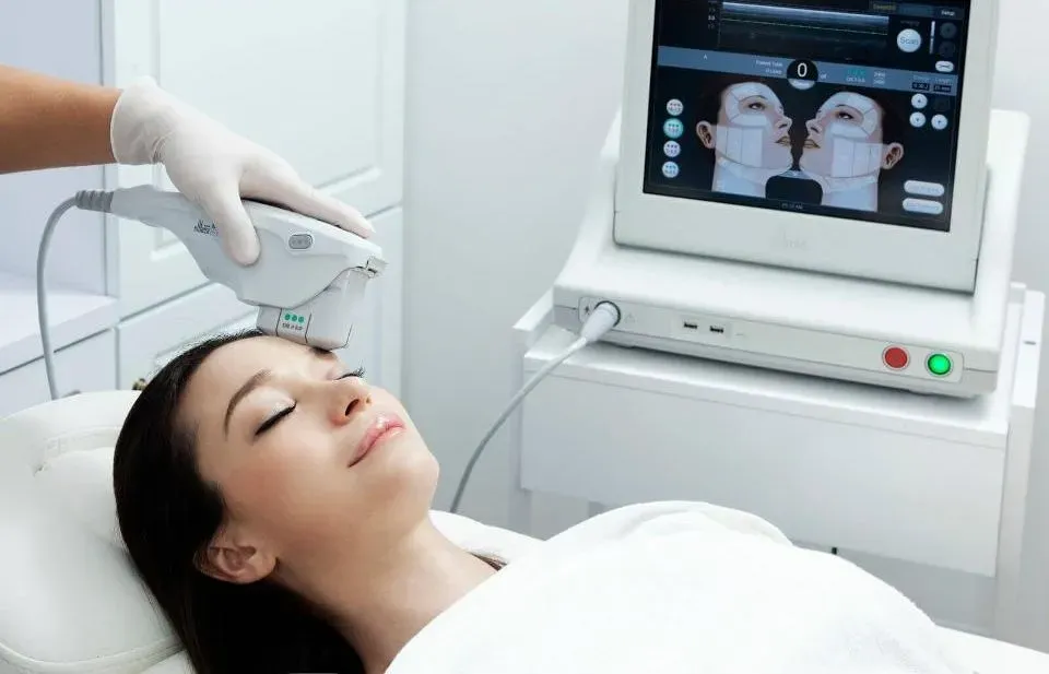 Ultherapy PRIME treatment in progress